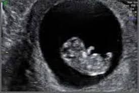 early scan